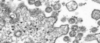 SARS-CoV-2 virus seen under electron microscope