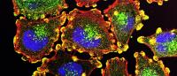 metastatic melanoma cells photo by Julio C. Valencia / NCI