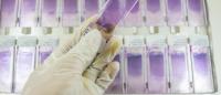 blood smear slides in a tray