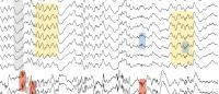 multiple trace recording of oscillations in brain activity