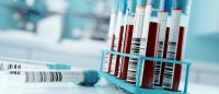 test tubes containing blood