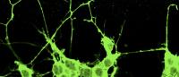 metastatic cancer cells sending out projections that look like axons