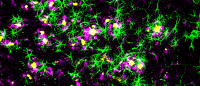 astrocytes and amyloid plaques in a mouse brain