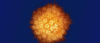 Colorized electron micrograph of the herpes simplex virus (HSV)