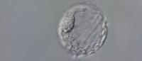 human embryo
