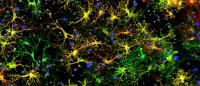 star-shaped brain astrocytes in a dish