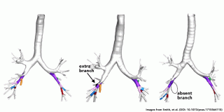 anatomic dead space in lungs anatomic dead space in lungs