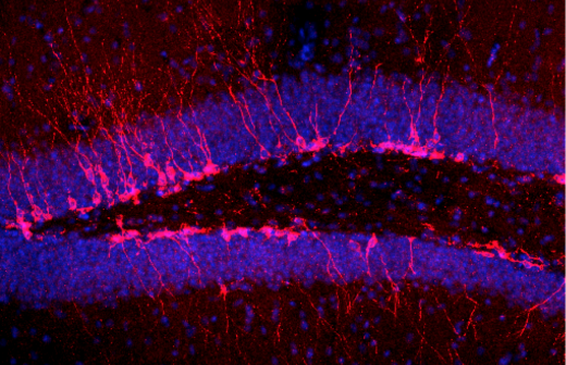 neurons shown in red and blue