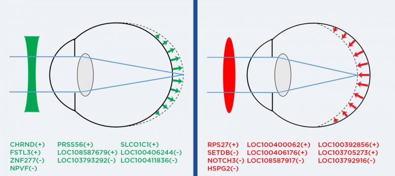 Shaping the Eye for Perfect Vision  Columbia University Irving Medical 